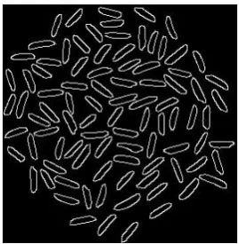 Fig 4: Canny Edge Detection 