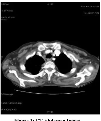 Figure 1: CT Abdomen Image 
