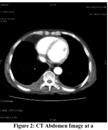 Figure 2: CT Abdomen Image at a Different Time Instance 