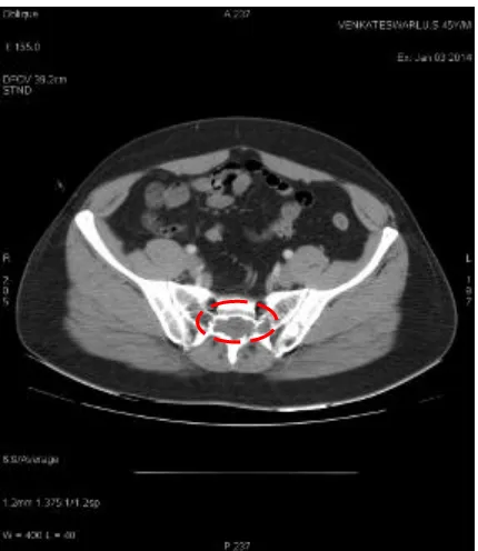 Figure 3(a): CT Image of NormalHealthy patient  