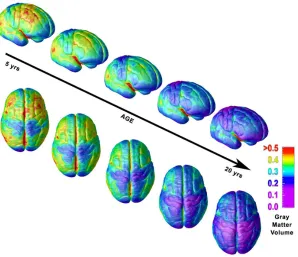 Fig. 2. Right lateral and top views of the dynamic sequence of GM maturation over the cortical surface