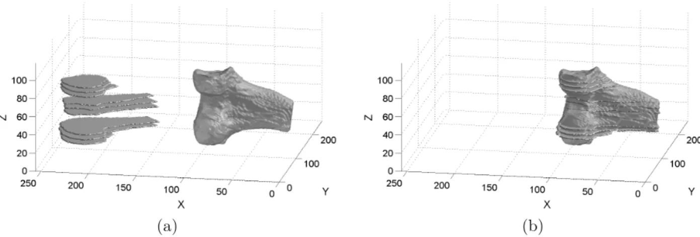 Figure 5. Rigid registration of a sparse, single fixed-flexion volume to the high-quality static volume (slices) for a femur bone: a) partial 3D volume and situation before registration, and b) situation after registration.