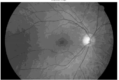 Fig.3.Optimal hyper plane in SVM 