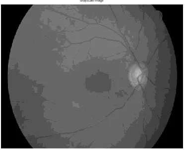 Fig.9.Pre-processed gray scale image 