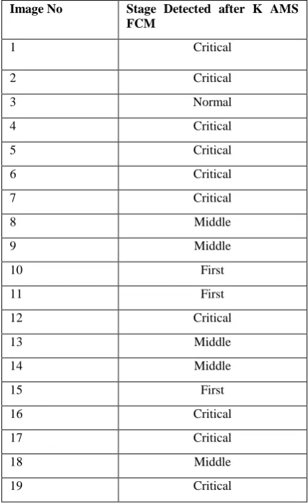 Fig 5: Output of SVM classification 