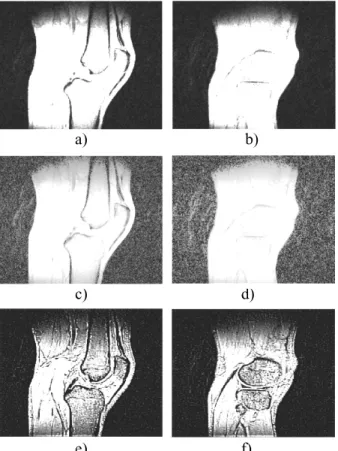 Fig. 5. Original images (1 st row ), histogram equalized images (2 nd row ), images enhanced by proposed method