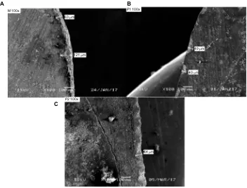 Figure 3 sample of a sectioned tooth bonded with (Abbreviation:A) ceramic, (B) metal, and (C) control under seM