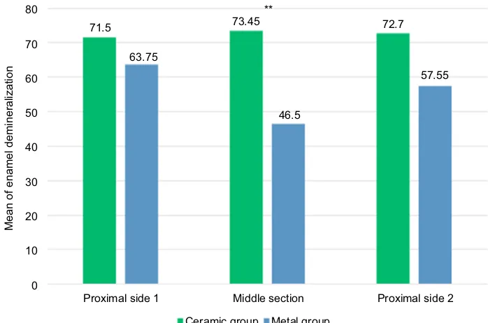 Figure 6 Comparing enamel demineralization between the ceramic and metal groups in three different sections.Note: **Statistically significant difference.