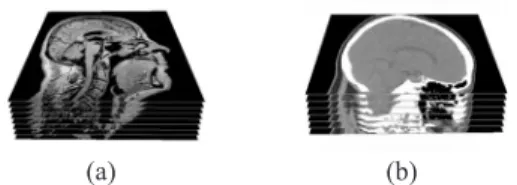 Fig. 2. Part of a typical stack of an MRI and of a CT dataset of the head.