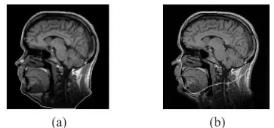 Fig. 7. First segmentation results of the template providing the desired information of the depth soft