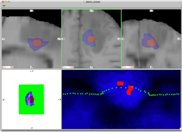 Figure 3.3: Experimental Software - A view of the PMP prototype is presented. Thetop row contains 2-D slice views
