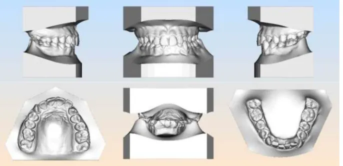 Figure 9 Posttreatment photographs.