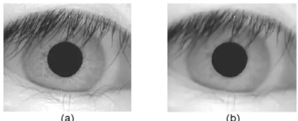 Figure  2: Anisotropic  filtering  based  on  Perona  and  Malik’s formulation [10]. (a) Original image