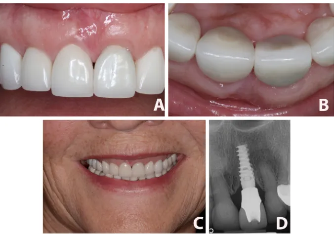 Figure 4 24-Month follow-up.