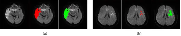 Figure 4. Contributions of different images: (a) Dice obtained from single image; (b) Dice obtained with one left out