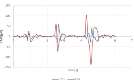 Figure 11. Right and left gaze motion signal. 