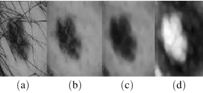 Fig. 3. Insufficiency of median filter for dark hair removal. ( a ) original image; ( b ) median filter result.