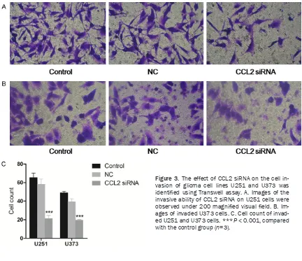 Figure 3. The effect of CCL2 siRNA on the cell in-vasion of glioma cell lines U251 and U373 was identified using Transwell assay