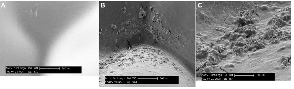 Figure 1 Clean orthodontic aligner not yet worn (A), after 2 weeks of use (B), and observed at higher magnification (C), observed under scanning electron microscopy.