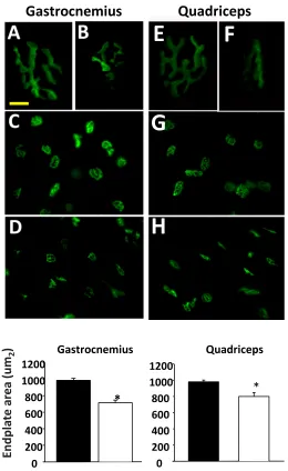 Figure  4Gastrocnemius