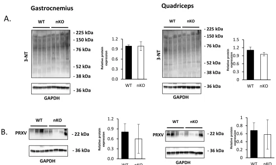 Figure 6Gastrocnemius Quadriceps 