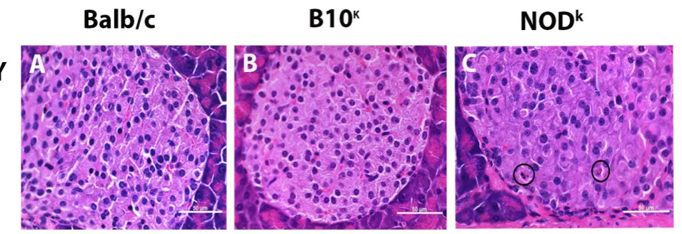 Figure 5.5. Representative image of H&E sections of pancreas for apoptosis in high fat diet (HFD) fed Balb/c, B10k and NODk at the time of harvest on the long-term study