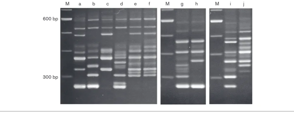 Fig. 1. Representative PCR ribotype patterns of C. difﬁcile isolates. Lanes: M, 100 bp ladder as a molecular mass marker; a,PCR ribotype og39; b, type 001; c, type 002; d, type 014; e, type 0189 (ysmz); f, type 018 (smz); g, type 017; h, type 369(trf); i, type 027; j, type 078.