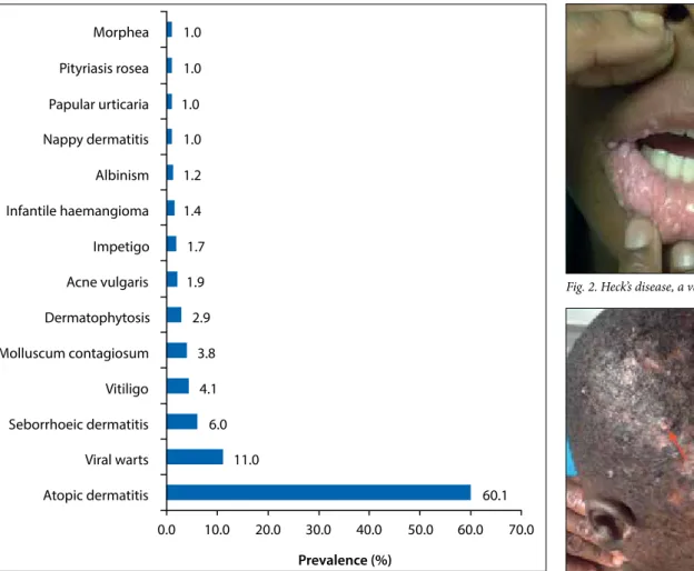 Fig. 1. Most prevalent skin disorders seen among the study population. 