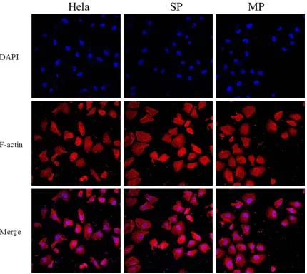 Figure 4. Size comparison of tumor formation among cervical cancer MP, SP cells and Hela cells in mice.