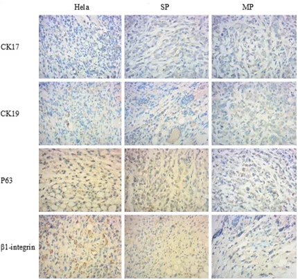 Figure 8. Related factors detection of Tumor cell body.