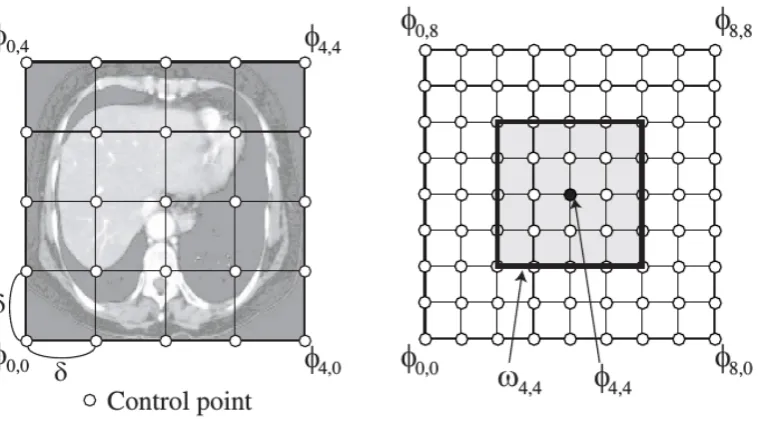 Figure 2.15: B-spline free-form deformations (FFDs). (a) Deformations of a ﬂoatingimage are performed by manipulating an overlaying mesh of control points and (b)a control point affects points only inside its 4δ × 4δ neighborhood domain