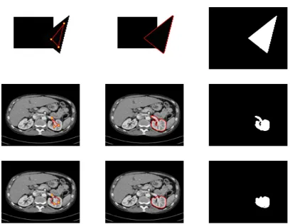 Figure 1: Results for Rada-Chen [28], for three test problems (given by rows 1-3). From left toright: initialization (with user input set A), nal contour, object selected