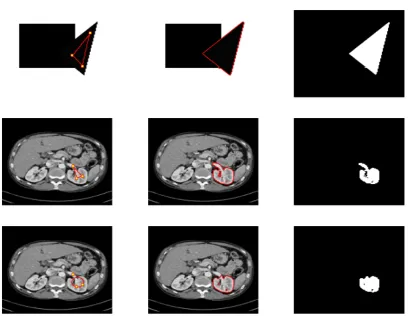 Figure 2: Results for DSS, for three test problems (given by rows 1-3). From left to right:initialization (with user input set A), nal contour, object selected