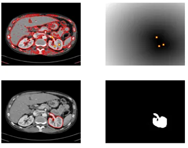 Figure 4: User input set 1 for CDSS. From left to right, top to bottom: initialization, Pdfunction (with user input set A4), nal contour, object selected.