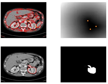 Figure 5: User input set 2 for CDSS. From left to right, top to bottom: initialization, Pdfunction (with user input set A5), nal contour, object selected.
