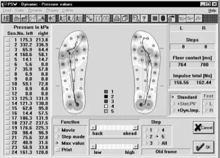 Fig. 2. The example pressure distribution on a foot in a dynamic part of data.