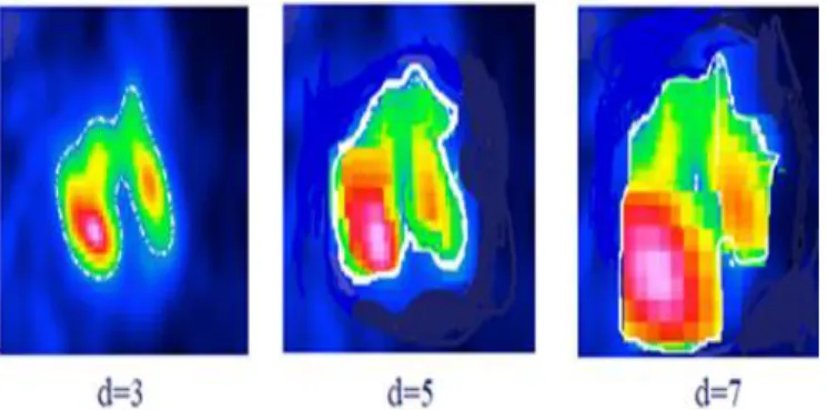 Fig 4.  Reason for this Approach: the information can be moved through  changing Dilated Levels from an Originally biased Area to other Regions