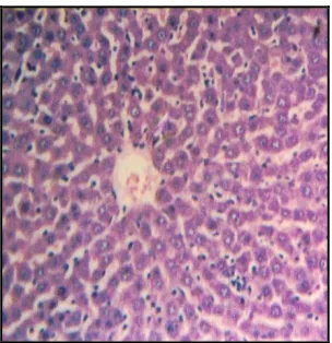 Figure 5:              Light micrograph of rat liver treated with CCl4and plant material 