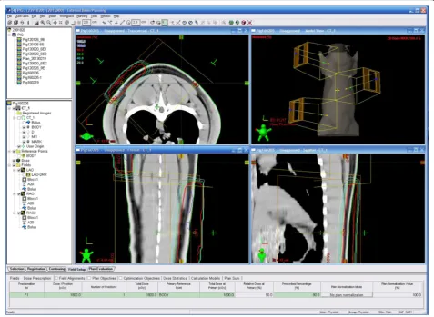 Fig. 1 The simulation of irradiation level using simulation software. The 18 Gy dose of radiation level is delineated by the red line