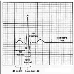 Fig 1: A Sample ECG 