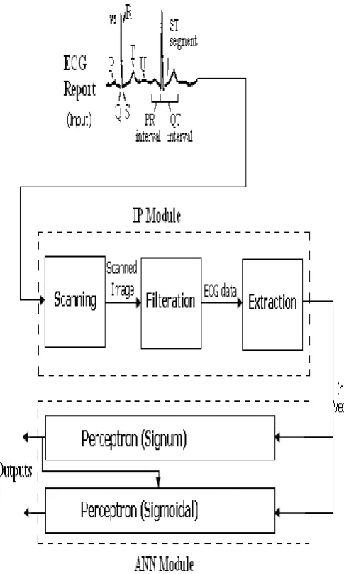 Fig 6: ECG Analysis model 