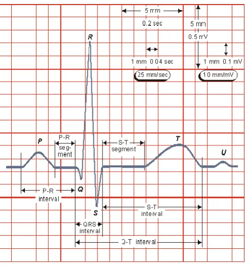 Fig 7: ECG wave form with feature vectors 