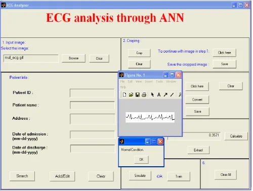 Fig 9:  ECG Analysis model  