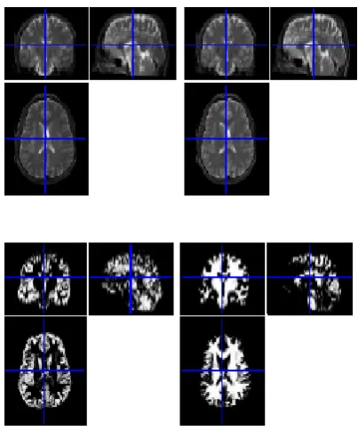 Figure 3 shows the example of SPM output for mutual–information coregistration. 