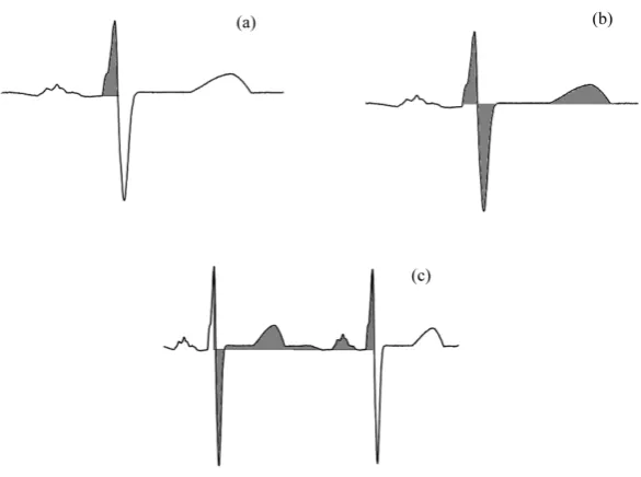 Figure 2. Range of ECG area calculations: (a) EDR1; (b) EDR2; (c) EDR3.                    