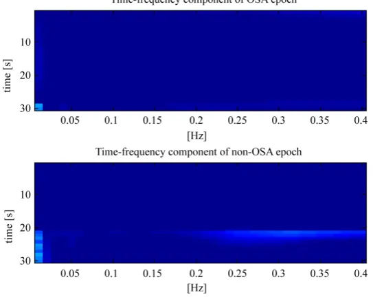 Figure 3. Time-frequency representation of EDR1 signal.                   
