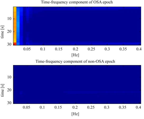 Figure 6. Time-frequency representation of HRV signal.                     