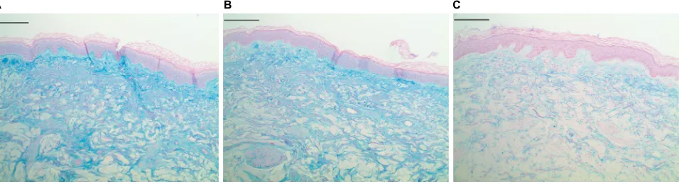 Figure 2 Fibrillin 1 dermal histology.Notes: Immunohistochemical staining for amyloid P (fibrillin surrogate marker), showing increased fibrillin signal in both the test material (A) (subject 4_site1_fibrillin_amyp a), and reference control (B) (subject4_s