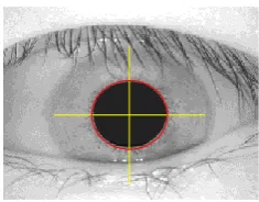 Figure 2 Detecting the Pupillary boundary 