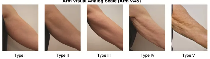 Figure 1 arm Visual analog scale for aging of the upper arms developed using the image bank from the current study.